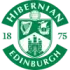Hibernian Women Football Team Results